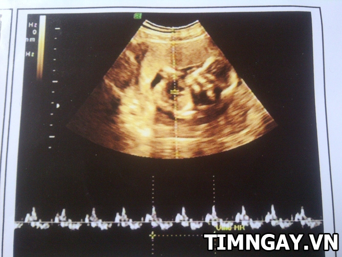 Bạn có tin vào những kinh nghiệm mang thai bé trai này không? 4