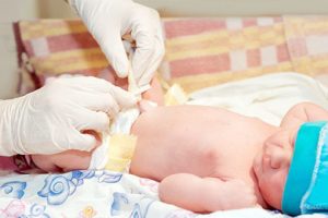 Cách chăm sóc rốn trẻ sơ sinh sau khi rụng an toàn cho bé