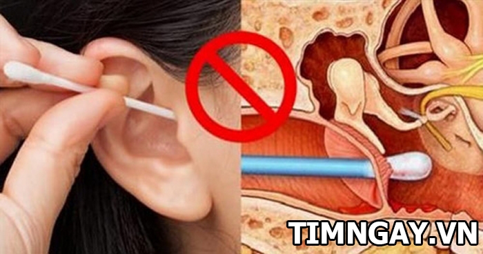 Cách lấy ráy tai khô không đau đơn giản và tuyệt đối an toàn 2
