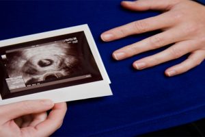 Chuyên gia giải đáp: thai nhi được mấy tuần mới có tim thai?